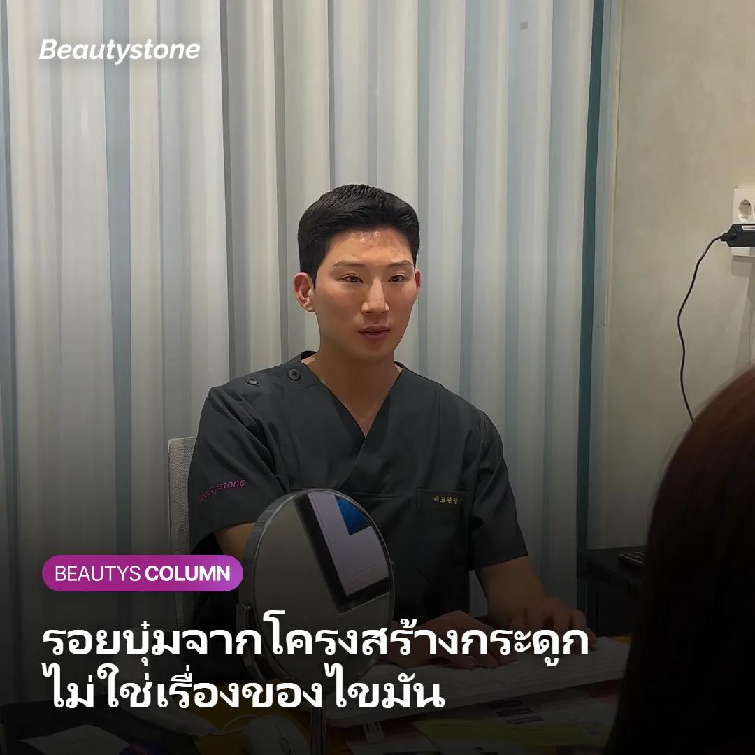 ภาพแสดงตำแหน่งรอยบุ๋มฮิปดิพที่เกิดจากโครงสร้างกระดูกเชิงกรานและกระดูกต้นขา