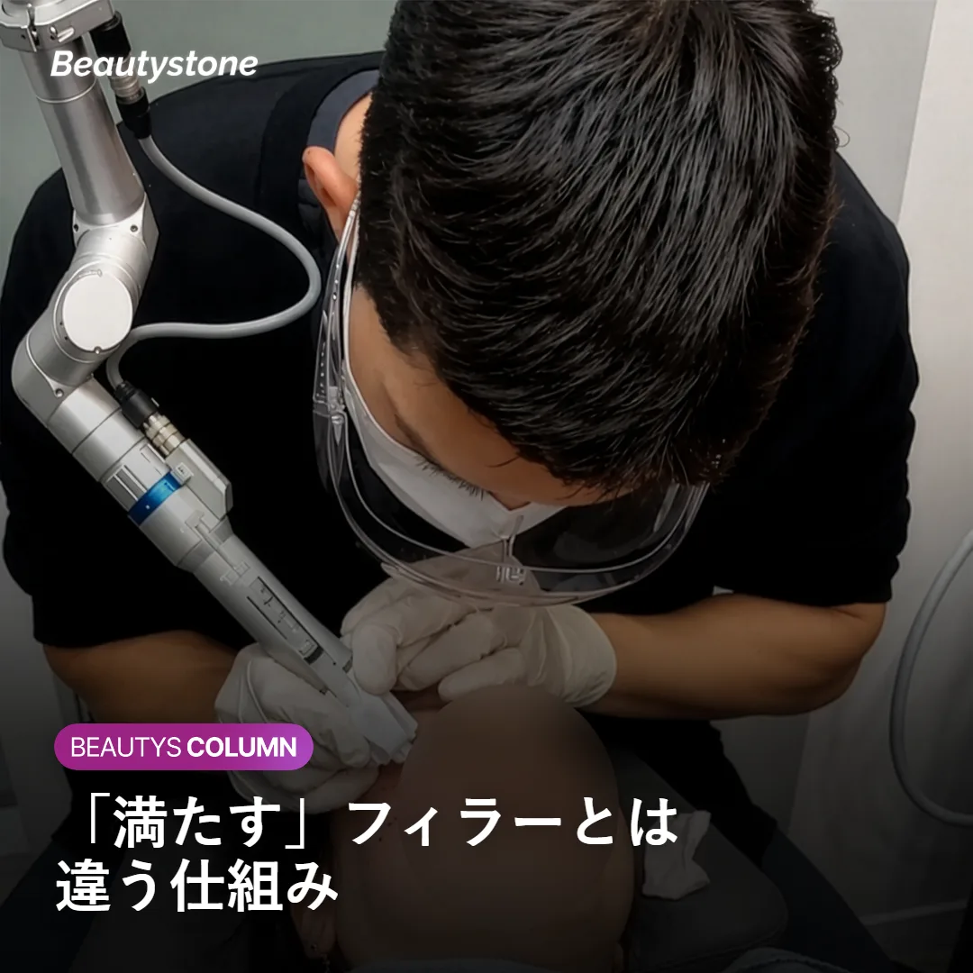 ヒアルロン酸フィラーとスカルプトラの仕組みの違いを示す図