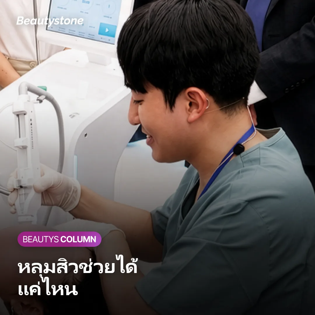 ภาพแสดงความแตกต่างของการตอบสนองต่อ Potenza ตามชนิดหลุมสิว