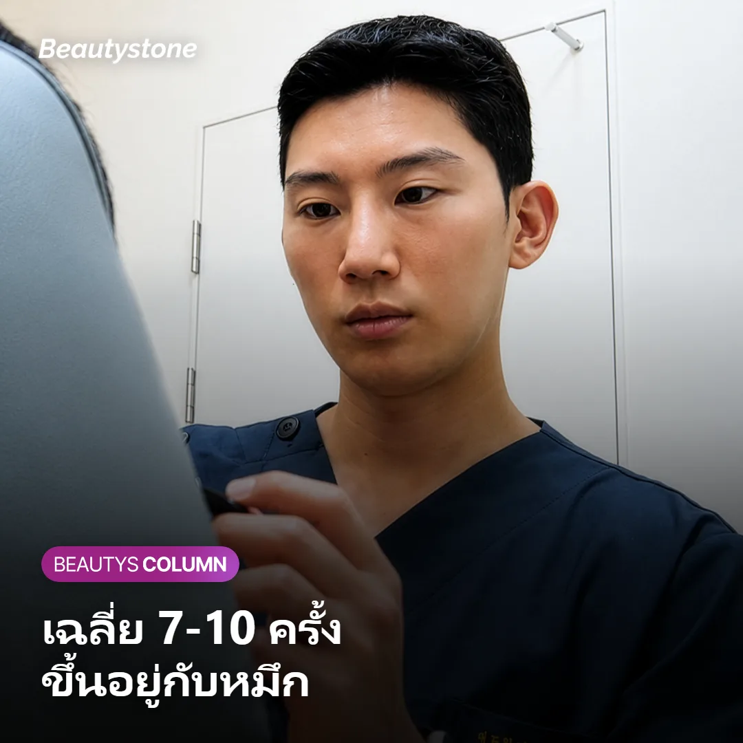 ภาพแสดงจำนวนครั้งโดยประมาณในการลบรอยสัก