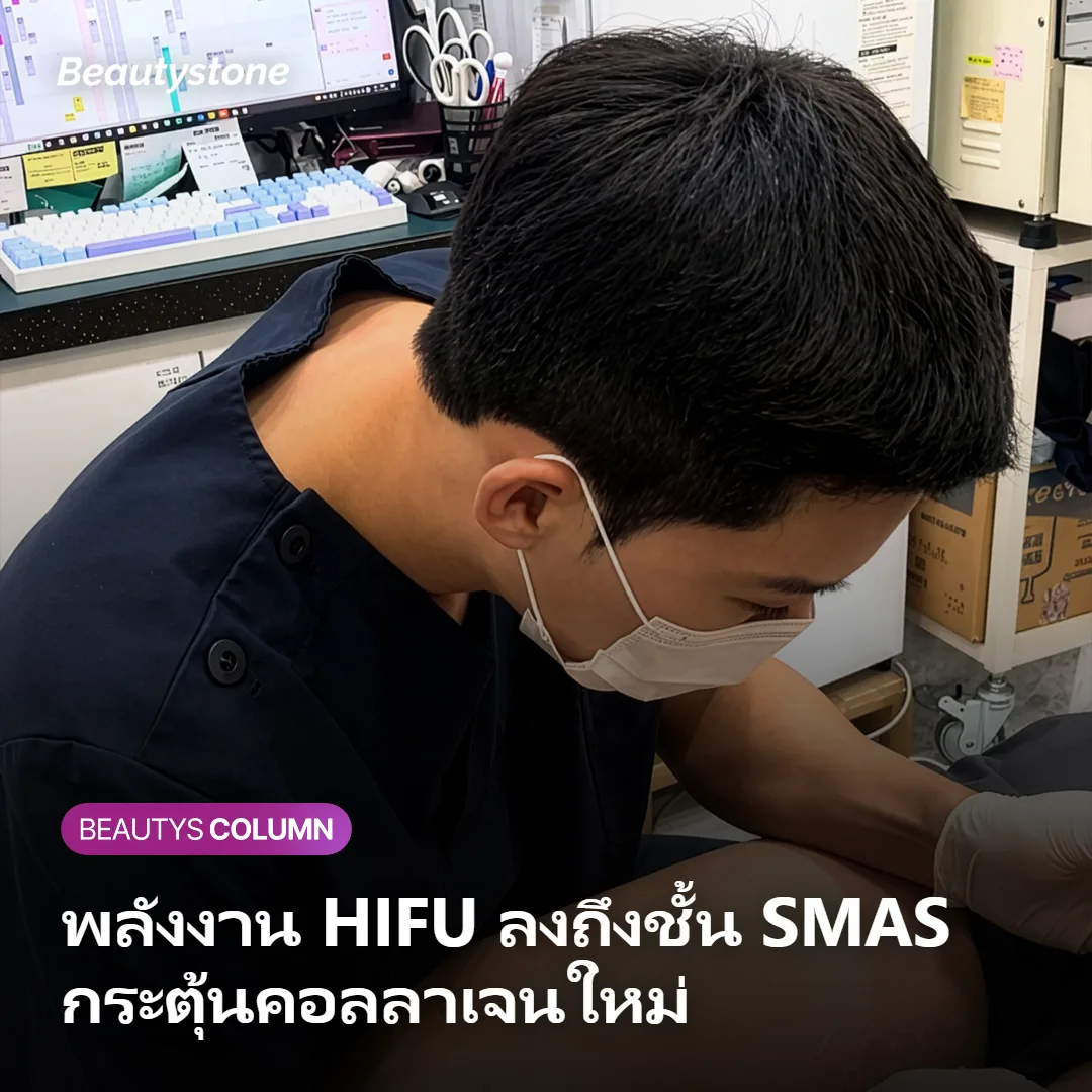 ภาพแสดงพลังงานคลื่นเสียงความถี่สูงลงถึงชั้น SMAS ใต้ผิวหนัง