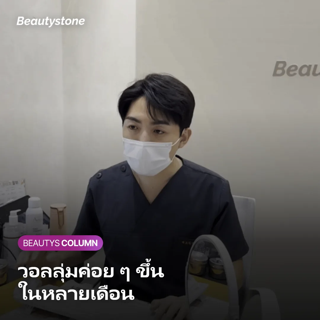 ภาพแสดงช่วงเวลาที่วอลลุ่มเริ่มขึ้นหลังฉีด Sculptra