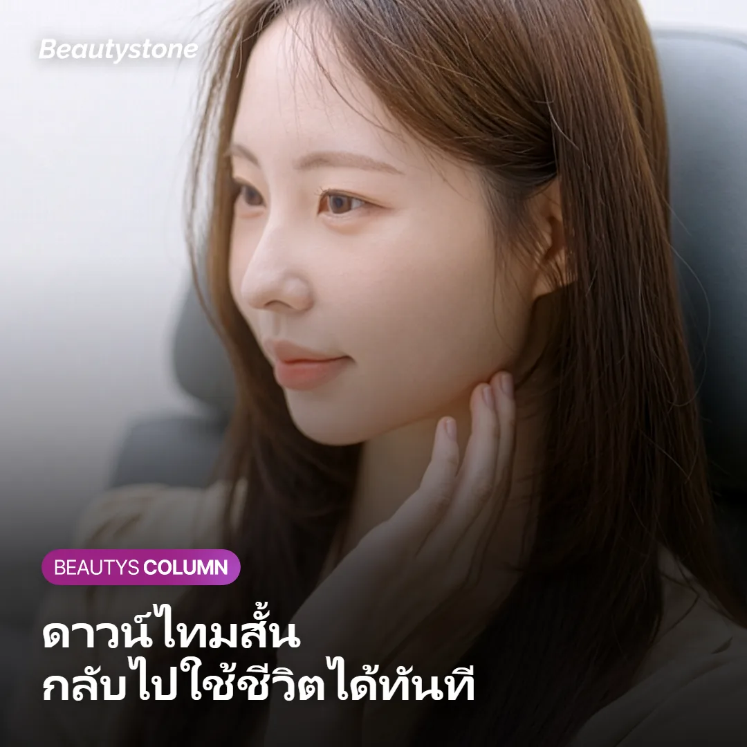 ภาพแสดงระยะเวลาดาวน์ไทมหลังทำ Onda