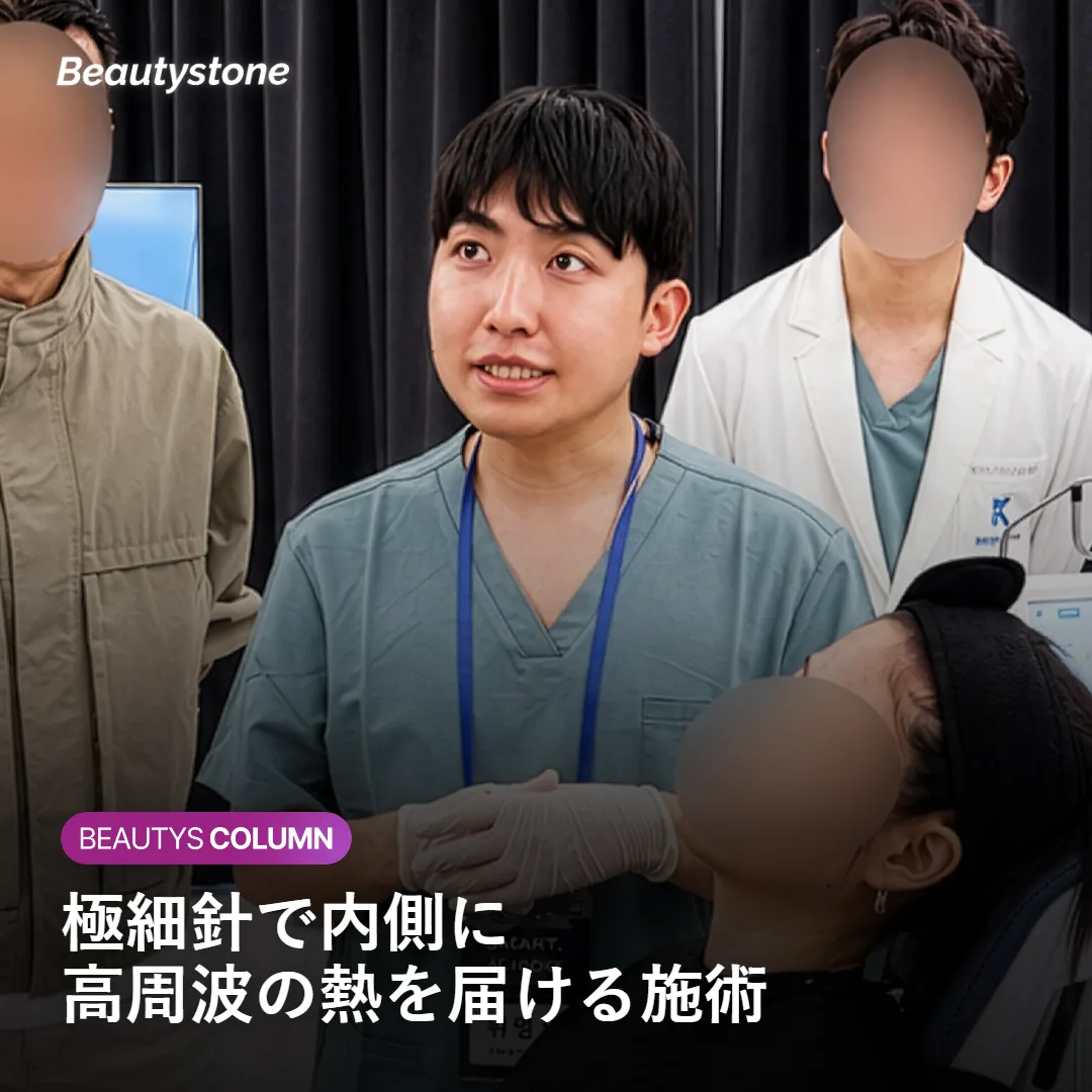 シークレットRFの施術の仕組みを示す図