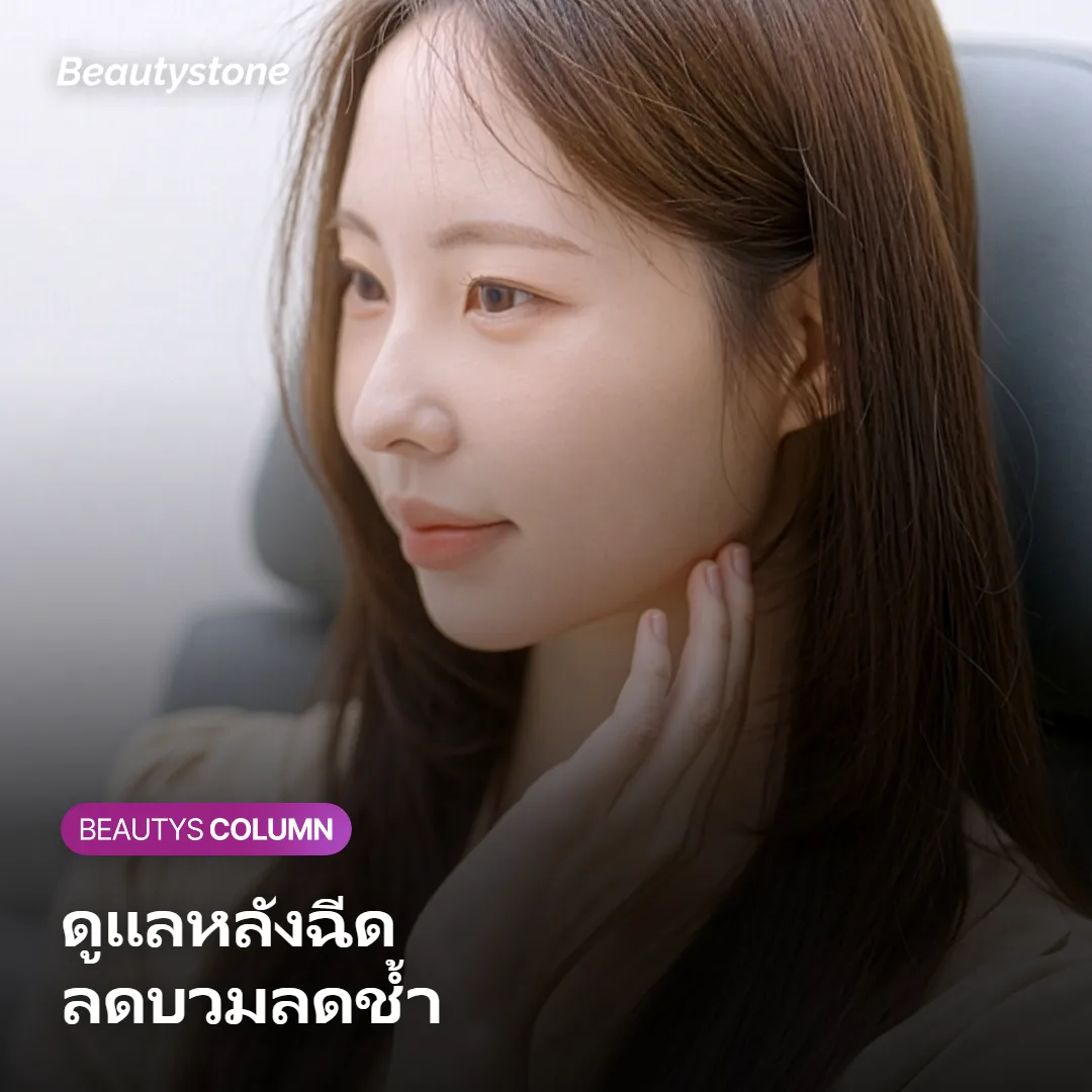ภาพแสดงวิธีดูแลตัวเองหลังฉีดฟิลเลอร์เพื่อลดบวมและลดช้ำ