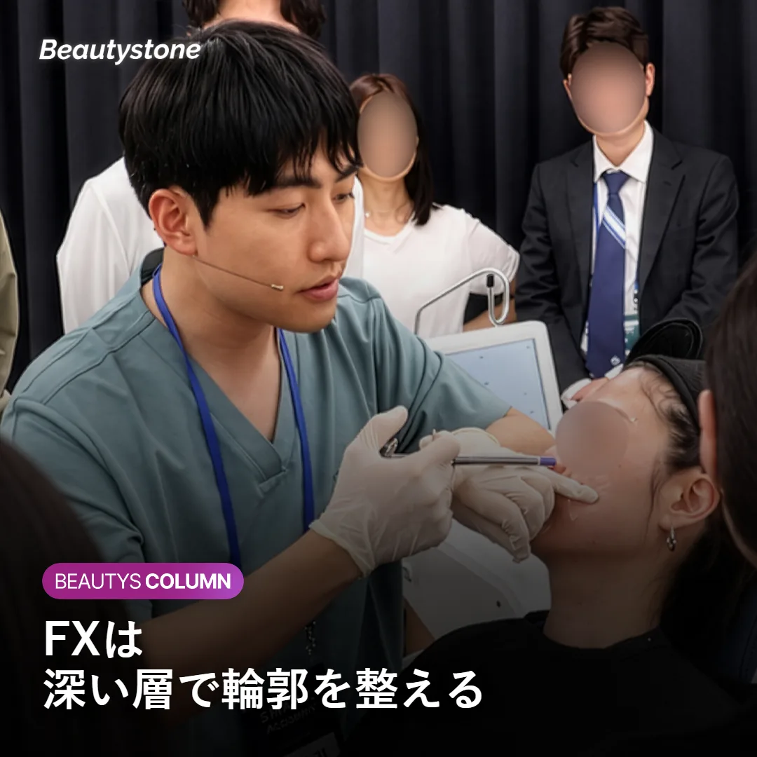 FXが深い層に届く仕組みを示す図