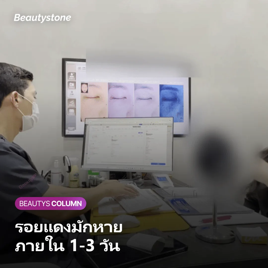 ภาพแสดงอาการรอยแดงหลังทำหัตถการที่มักหายภายในไม่กี่วัน