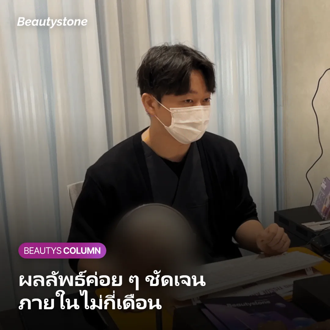 ภาพแสดงระยะเวลาที่ผลลัพธ์ของ Oligio X ค่อย ๆ ชัดเจนขึ้น