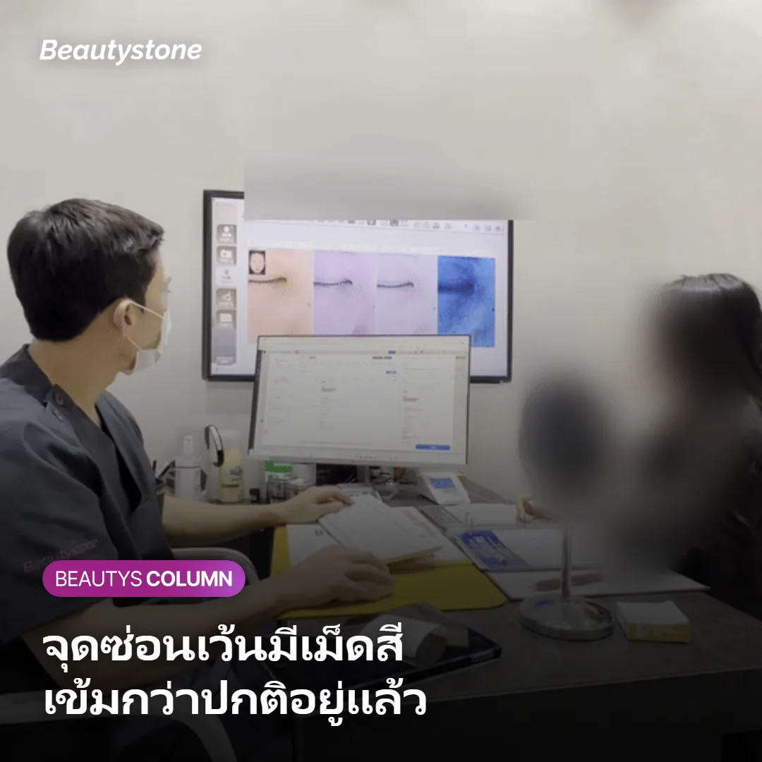 ภาพแสดงสาเหตุที่จุดซ่อนเว้นมีเม็ดสีเข้มกว่าปกติ