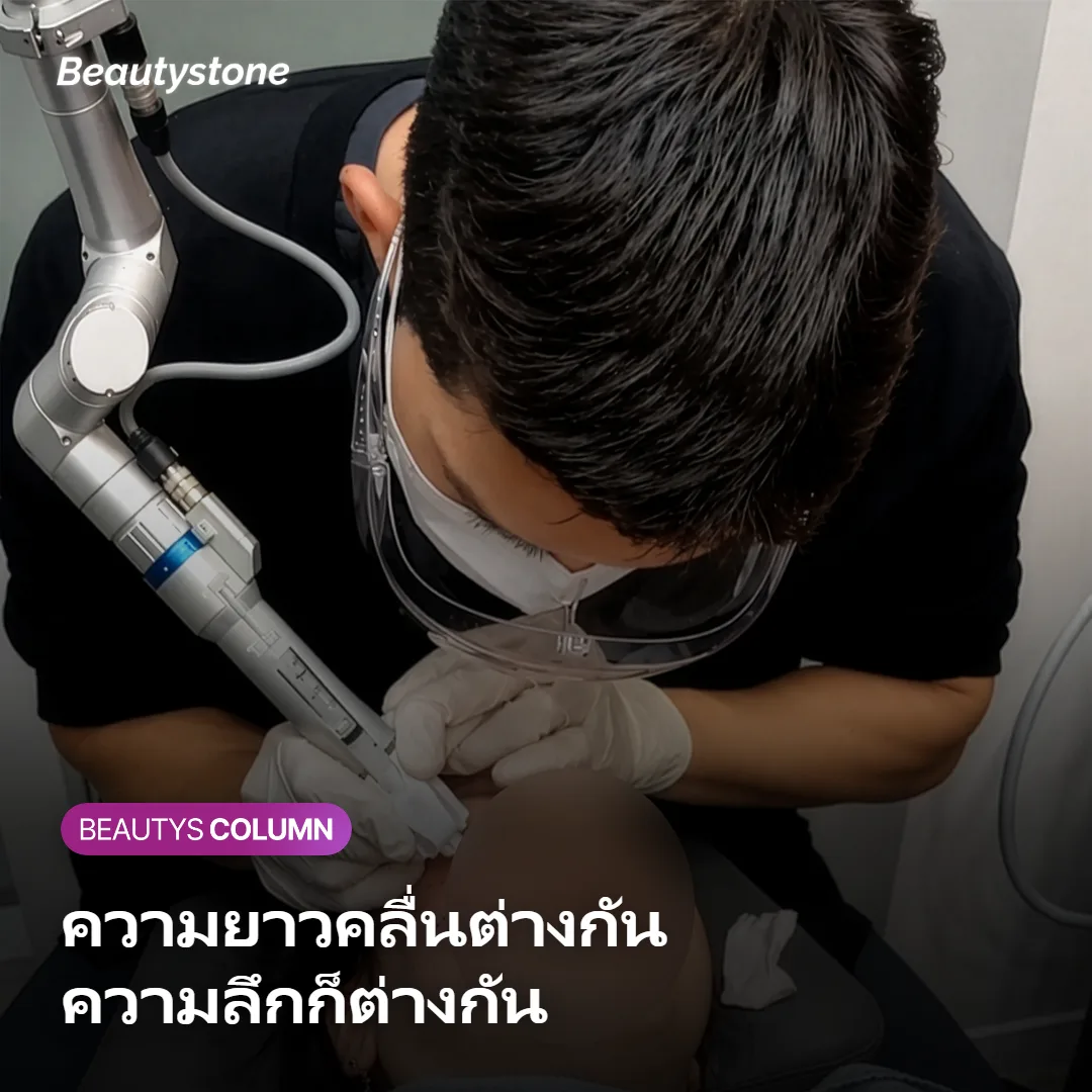 ภาพแสดงการเปรียบเทียบความยาวคลื่น 755nm และ 1064nm