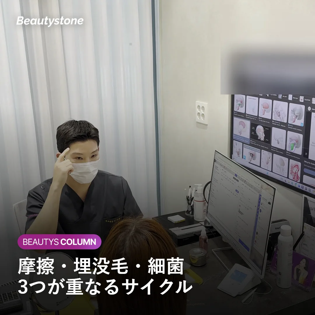 ひげ剃り後に毛嚢炎が繰り返される仕組みを示す図