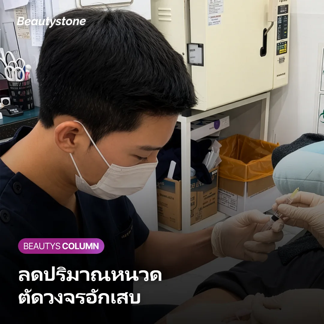 ภาพแสดงกลไกที่เลเซอร์กำจัดหนวดช่วยตัดวงจรสิวโกนหนวด