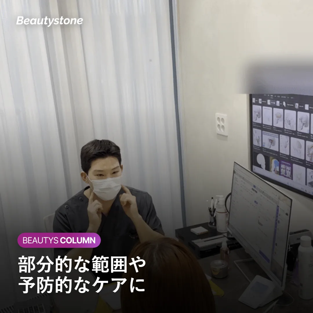 300ショットで十分な部分的な施術範囲を示す図