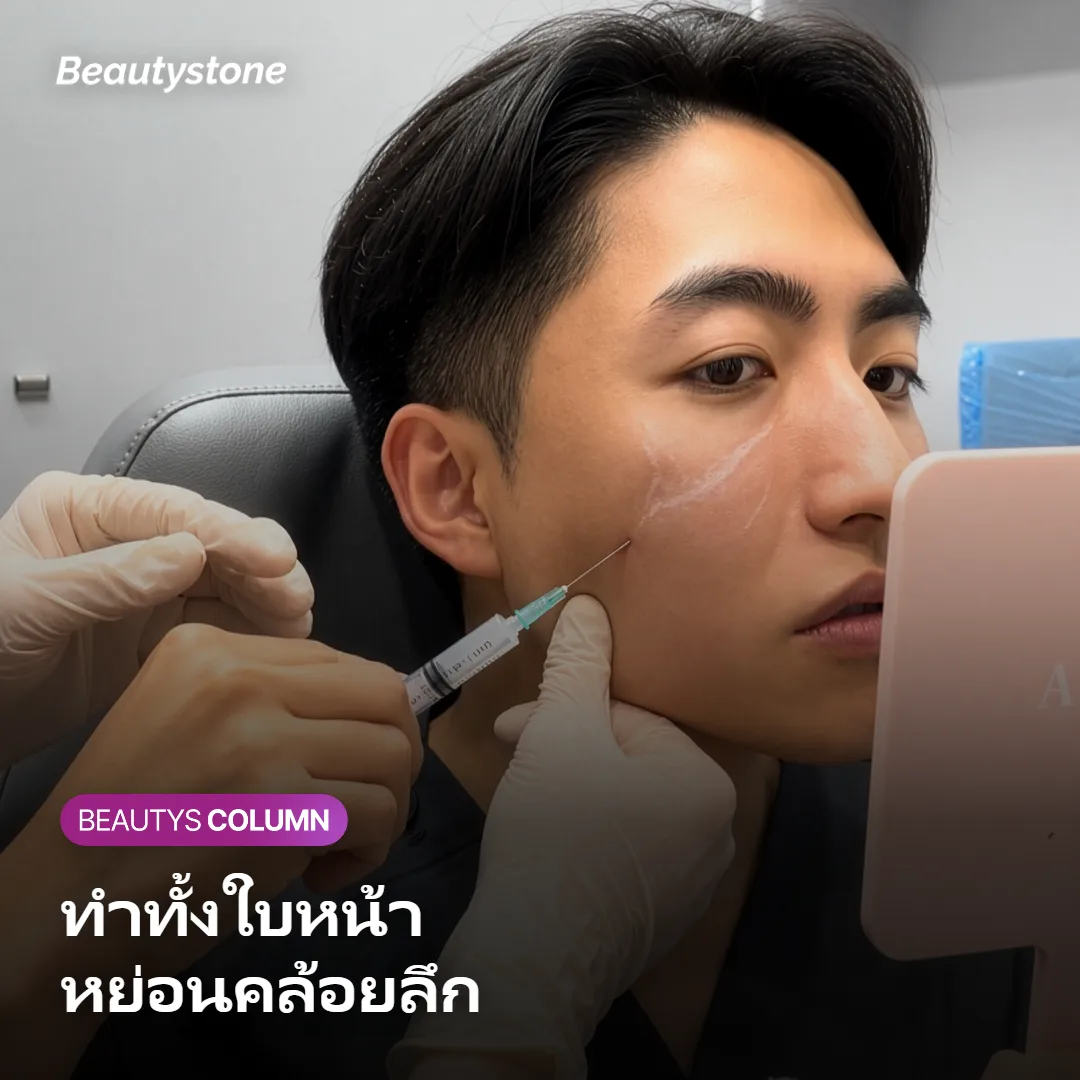 ภาพแสดงผู้ที่เหมาะกับการทำ Thermage FLX 600 ช็อตทั้งใบหน้า