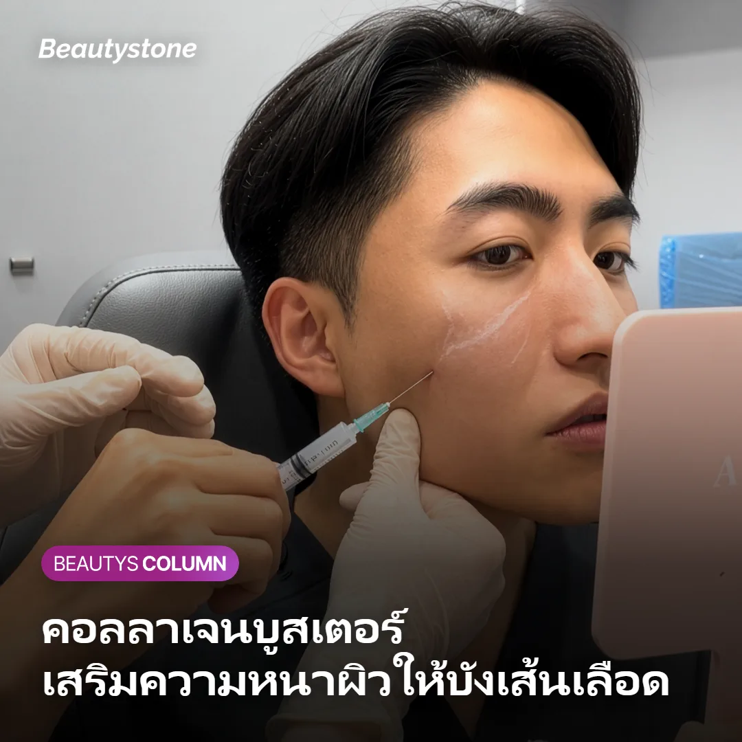 ภาพแสดงการทำคอลลาเจนบูสเตอร์เพื่อเสริมความหนาผิวใต้ตา