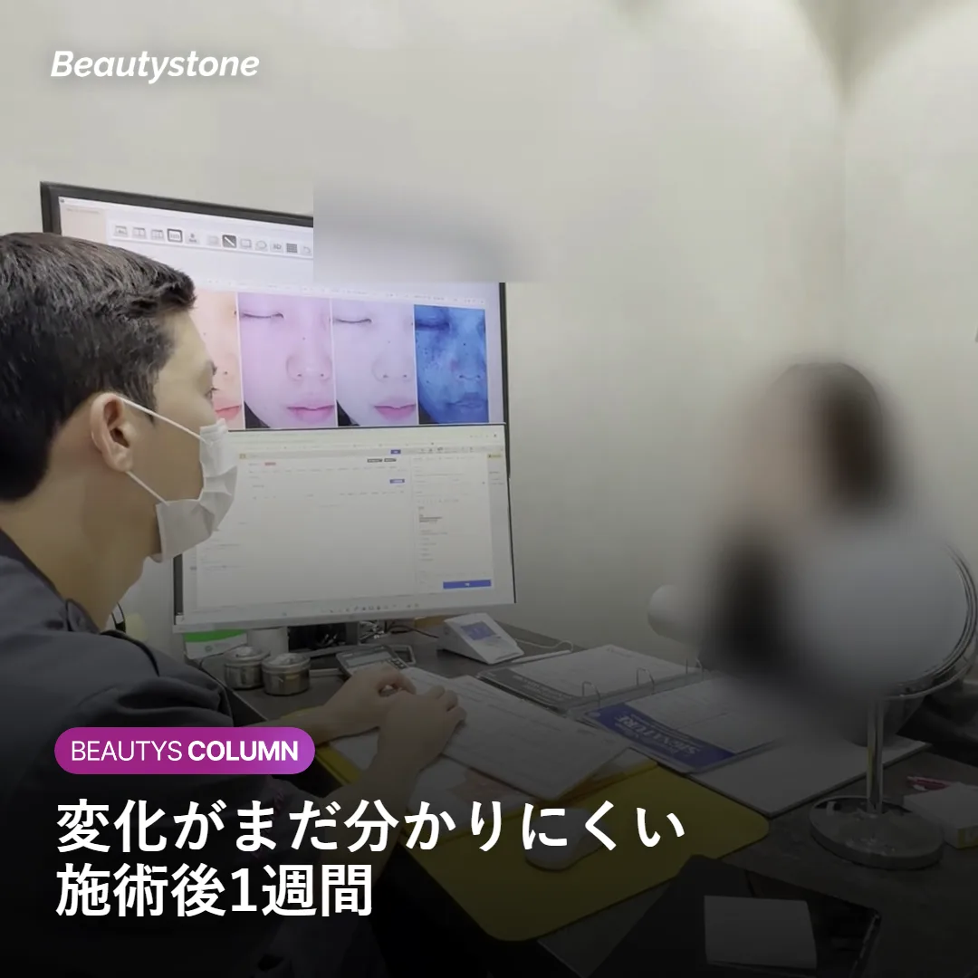 施術後1週間の肌の状態を示すイメージ