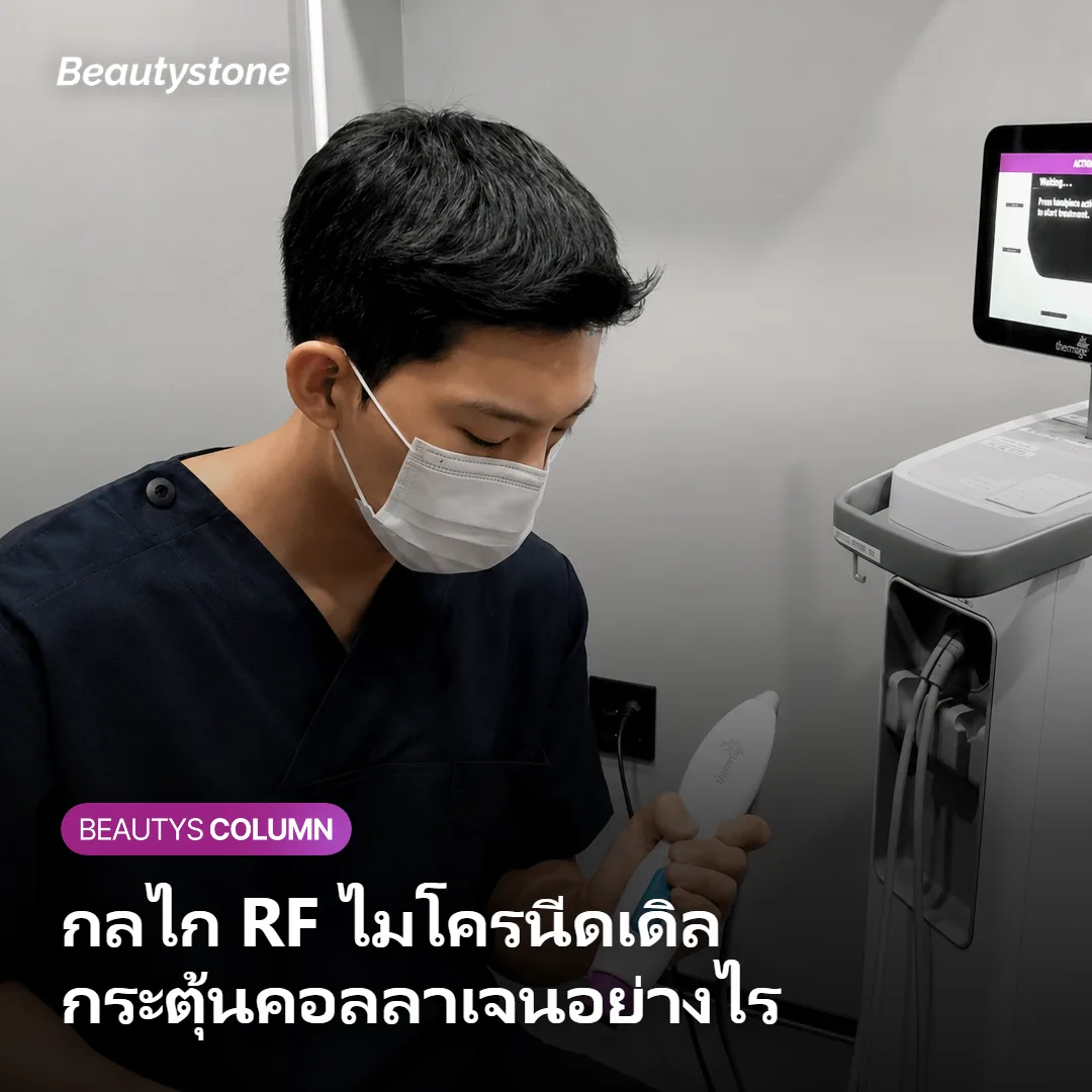 ภาพแสดงกลไกที่ Potenza ส่งพลังงาน RF ลงสู่ชั้นหนังแท้