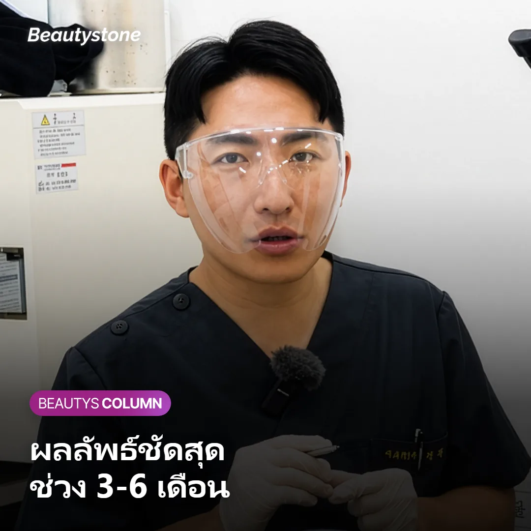 ภาพแสดงช่วงเวลาที่ผลลัพธ์ของ Ulthera PRIME ชัดเจนที่สุดในช่วง 3-6 เดือน