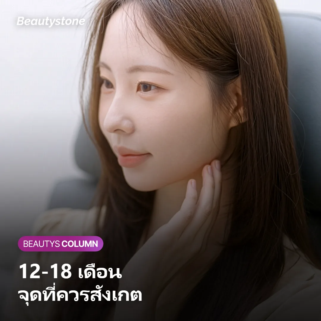 ภาพแสดงแนวโน้มที่หน้าจะเริ่มหย่อนคล้อยอีกครั้งช่วง 12-18 เดือน
