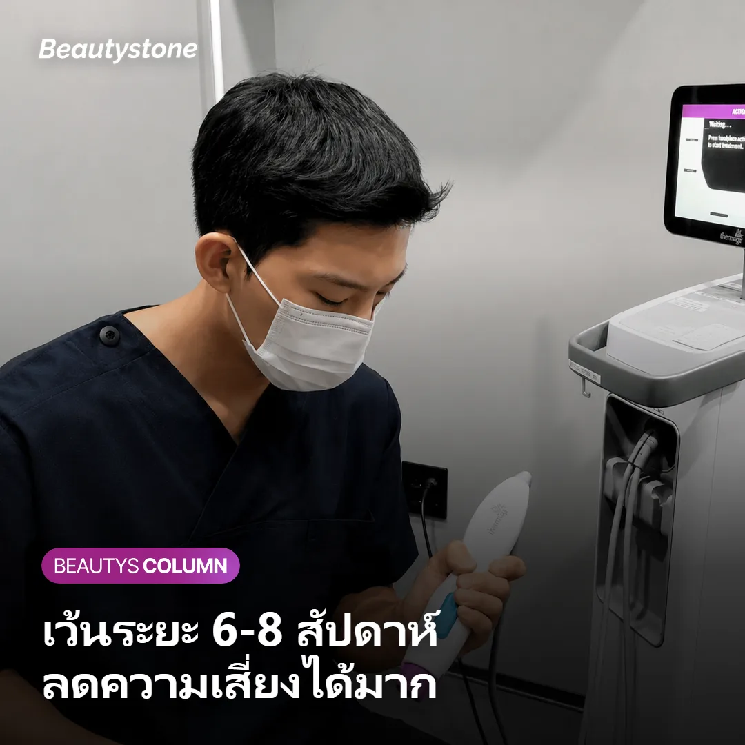 ภาพแสดงระยะห่างการทำ Sculptra แต่ละครั้ง