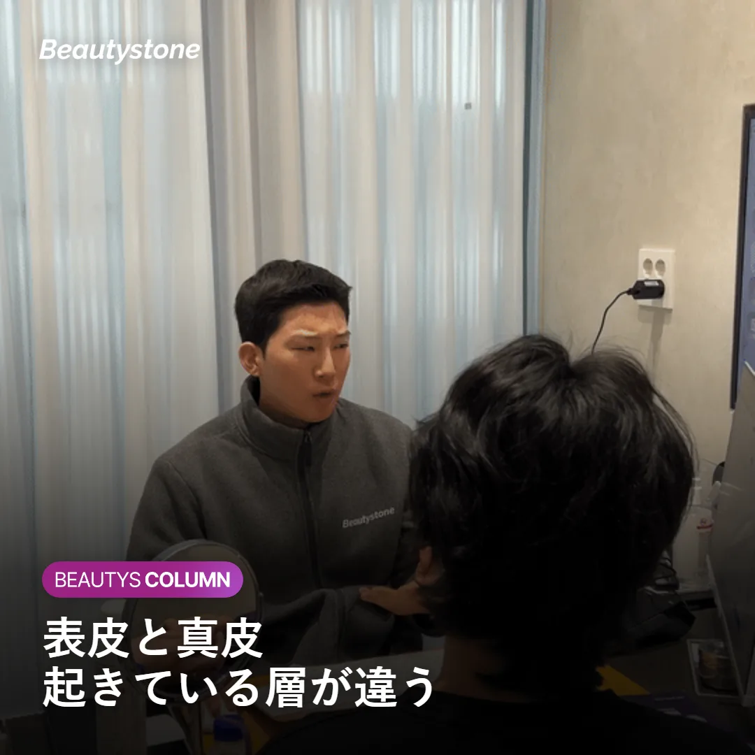 表皮と真皮、それぞれで起きる肌トラブルの違いを示す図