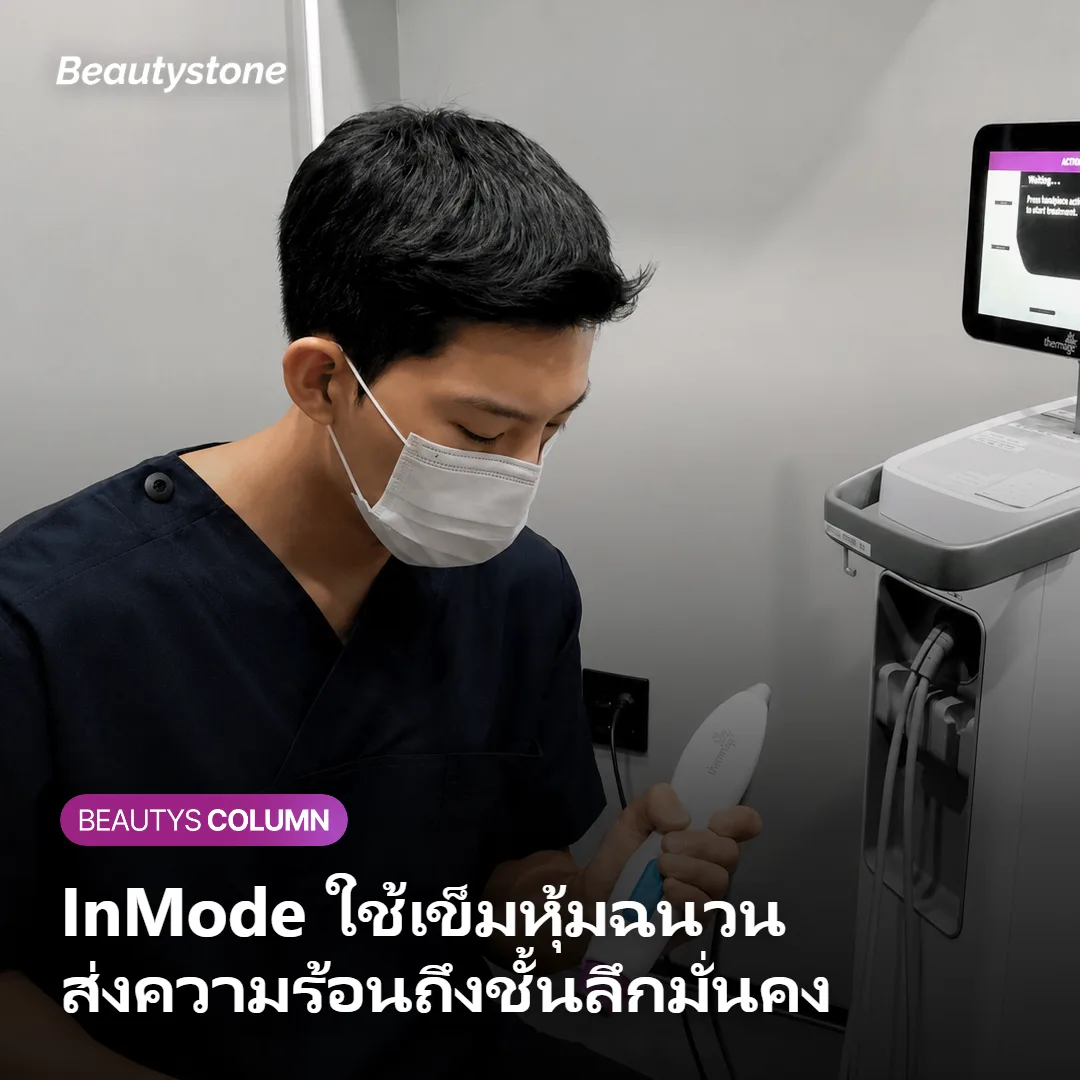 ภาพแสดงเข็มหุ้มฉนวนของ InMode ส่งความร้อนลงชั้นหนังแท้ลึก