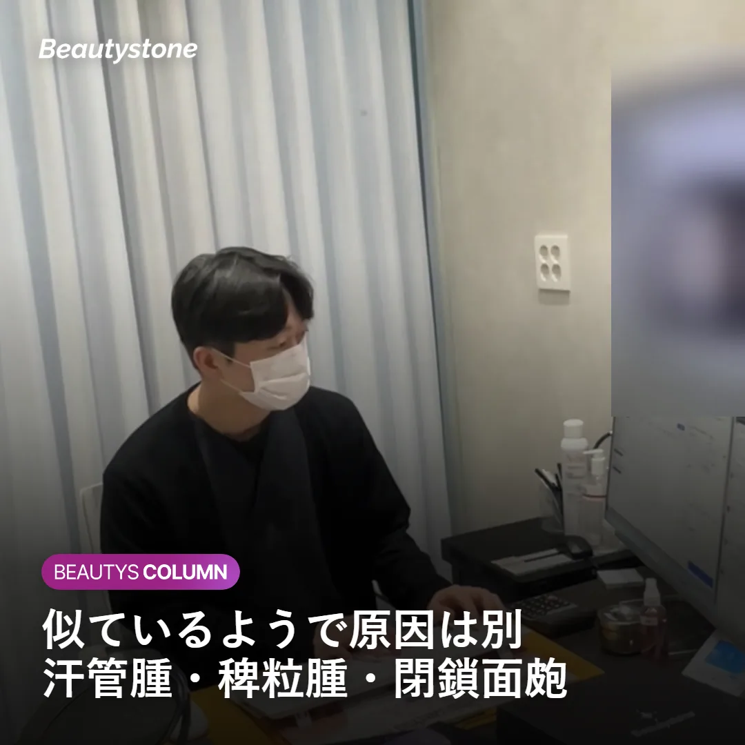 汗管腫・稗粒腫・閉鎖面皰の違いを示す図