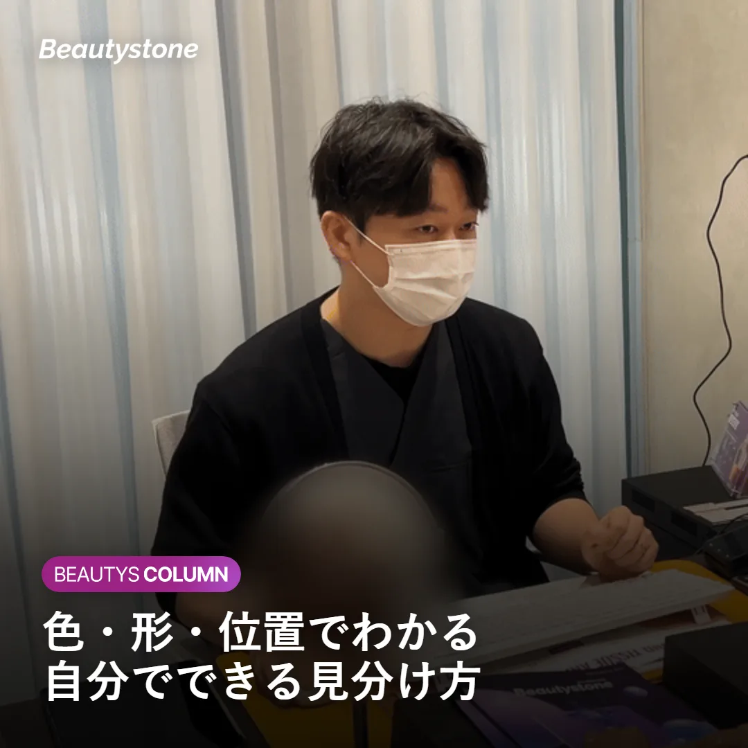 小さな粒の自己チェックポイントを示す図
