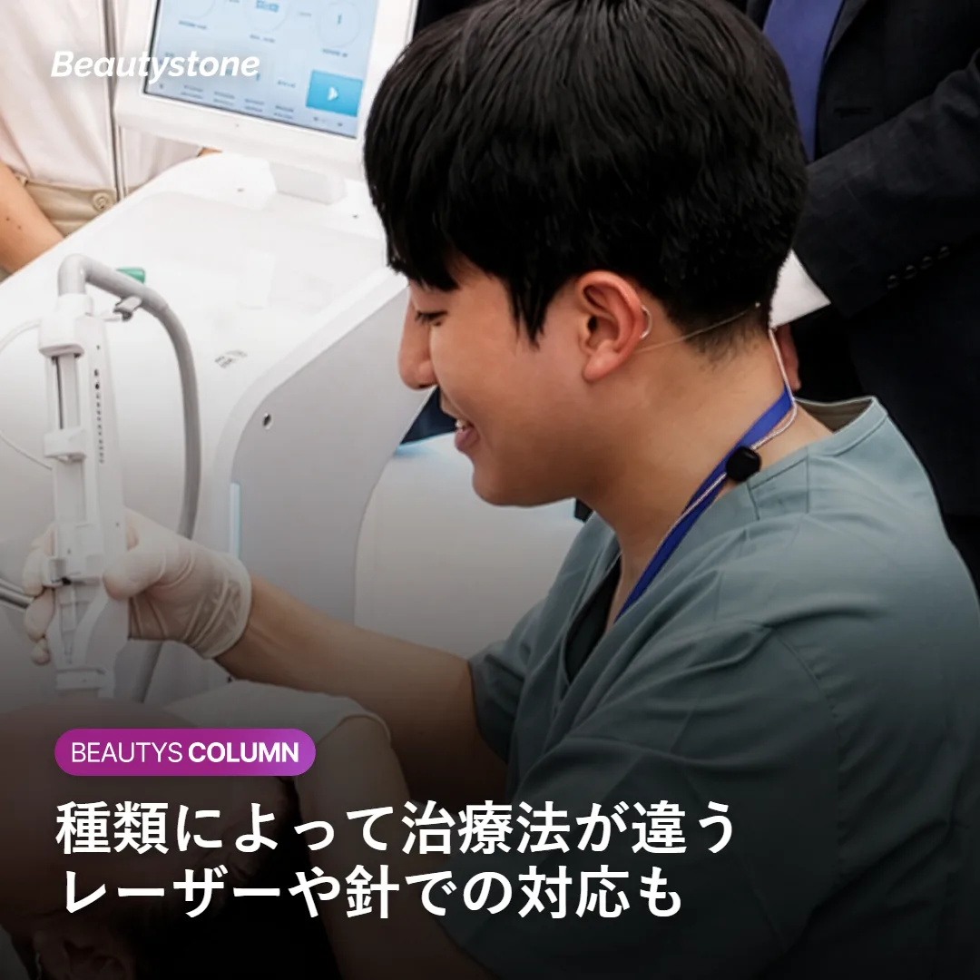粒の種類別の治療法を示す図