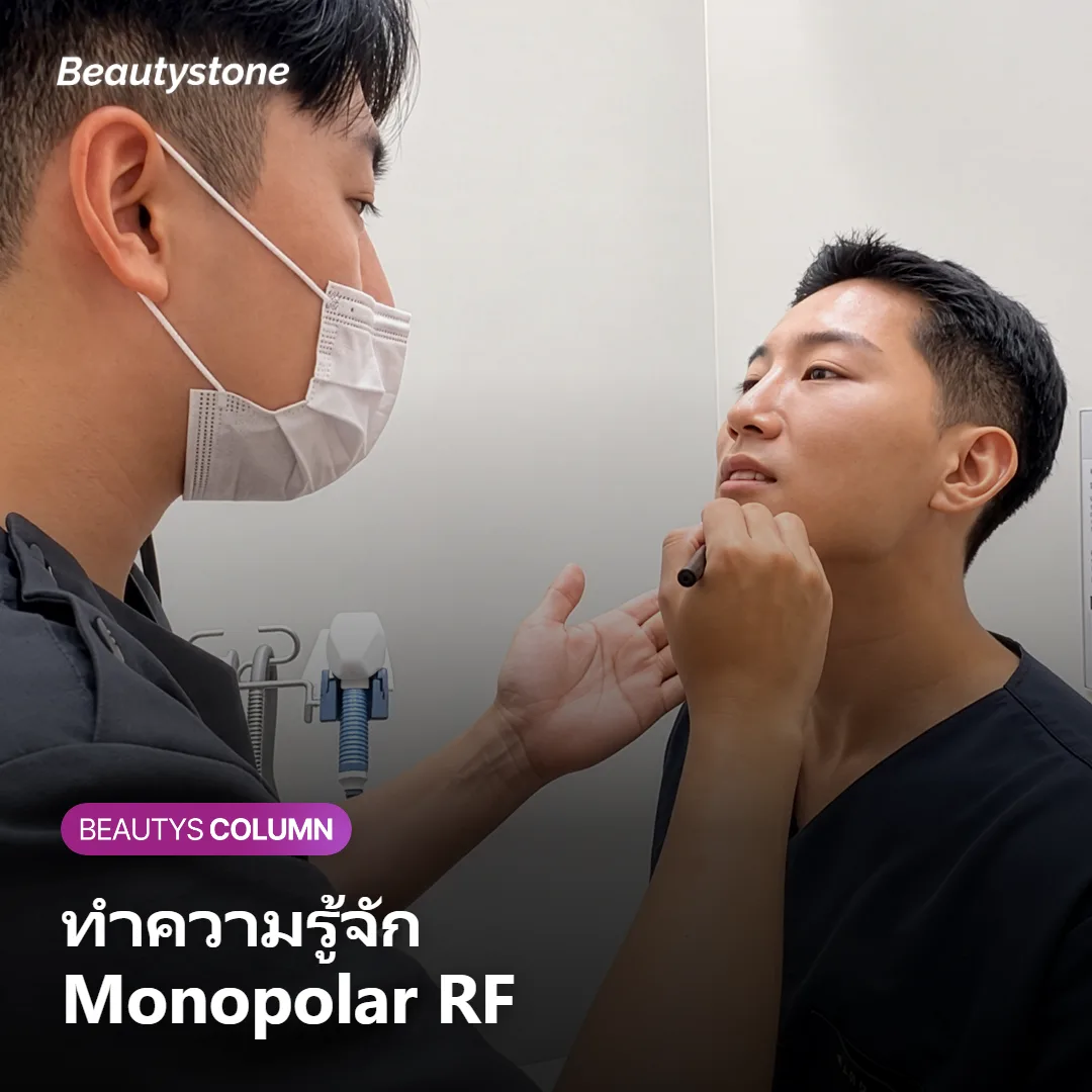ภาพแสดงกลไกการทำงานของ Monopolar RF ที่ส่งความร้อนถึงชั้นหนังแท้และ SMAS
