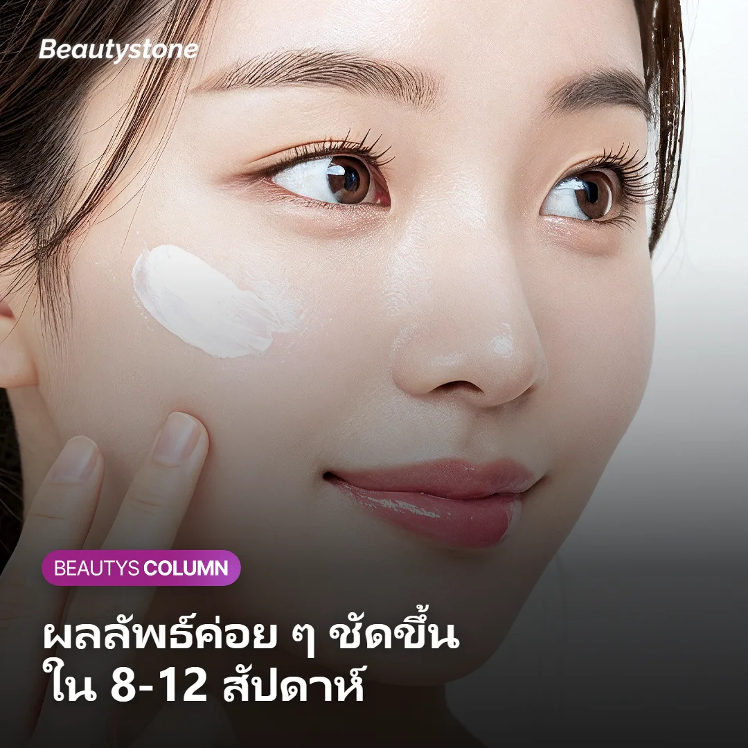 ภาพแสดงระยะเวลาที่ผลลัพธ์ของ Sofwave เริ่มเห็นชัดใน 8-12 สัปดาห์