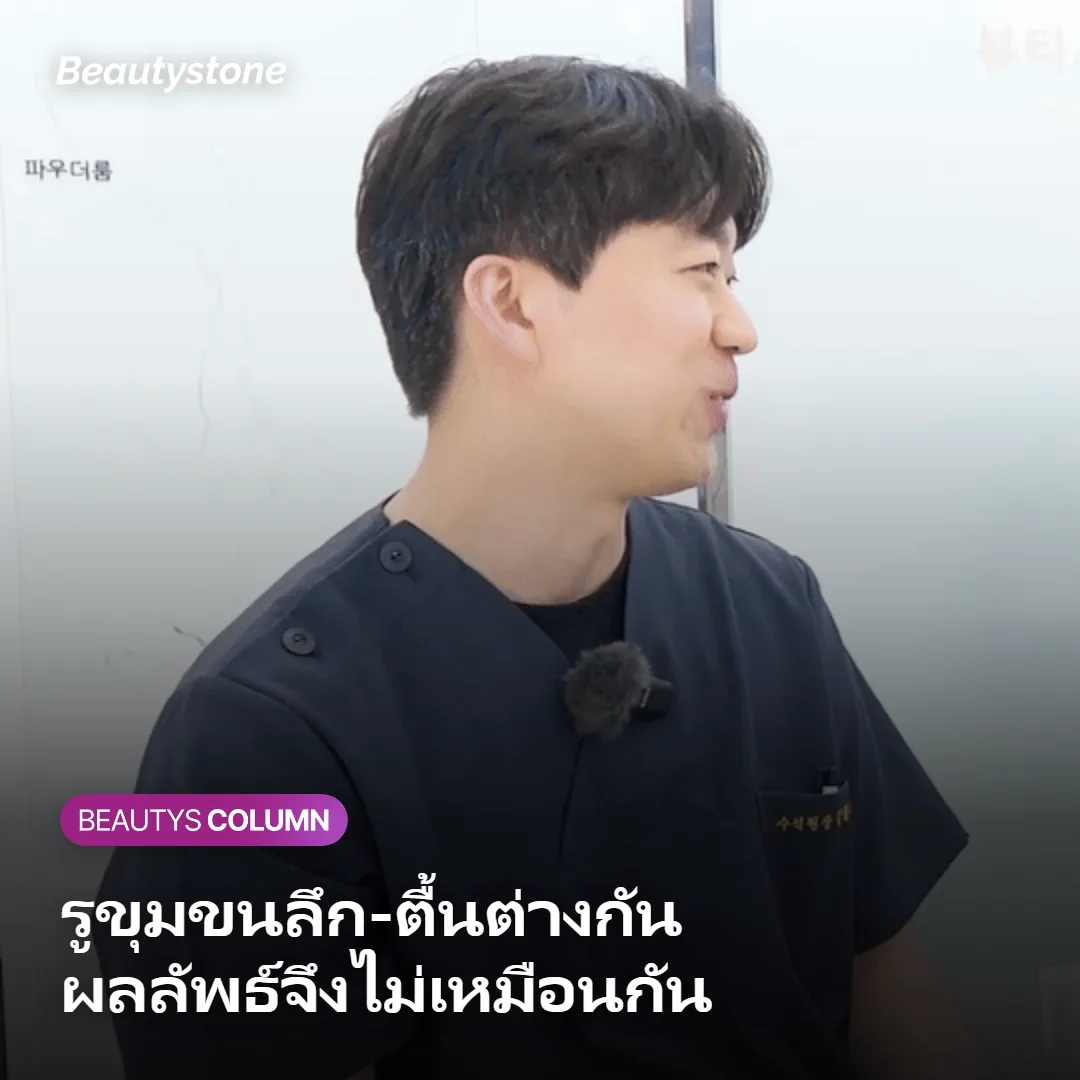 ภาพแสดงความแตกต่างของรูขุมขนเคราและขนอ่อน