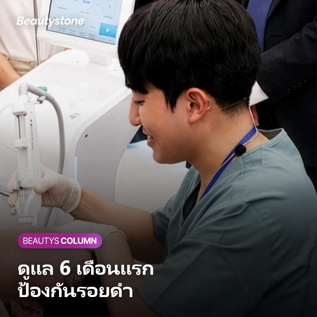 ภาพแสดงการทาครีมกันแดดดูแลผิวต่อเนื่องในช่วง 6 เดือนแรกหลังลบรอยสัก