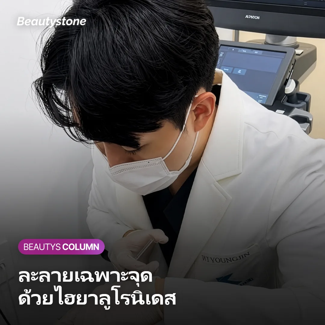 ภาพแสดงการละลายฟิลเลอร์ปากเฉพาะจุดด้วยไฮยาลูโรนิเดส