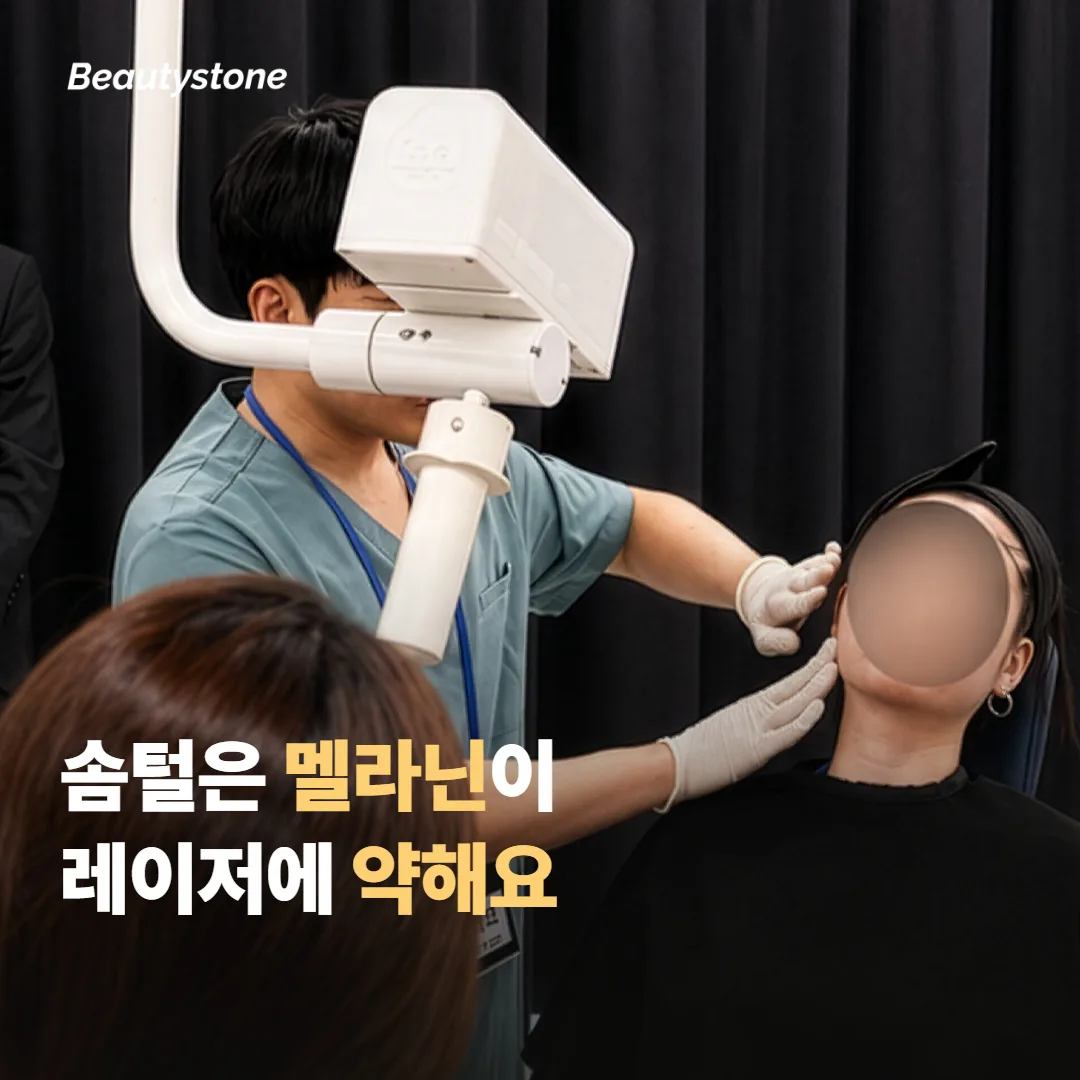 얼굴 솜털과 화장 들뜸, 무엇이 먼저 신경 쓰이세요