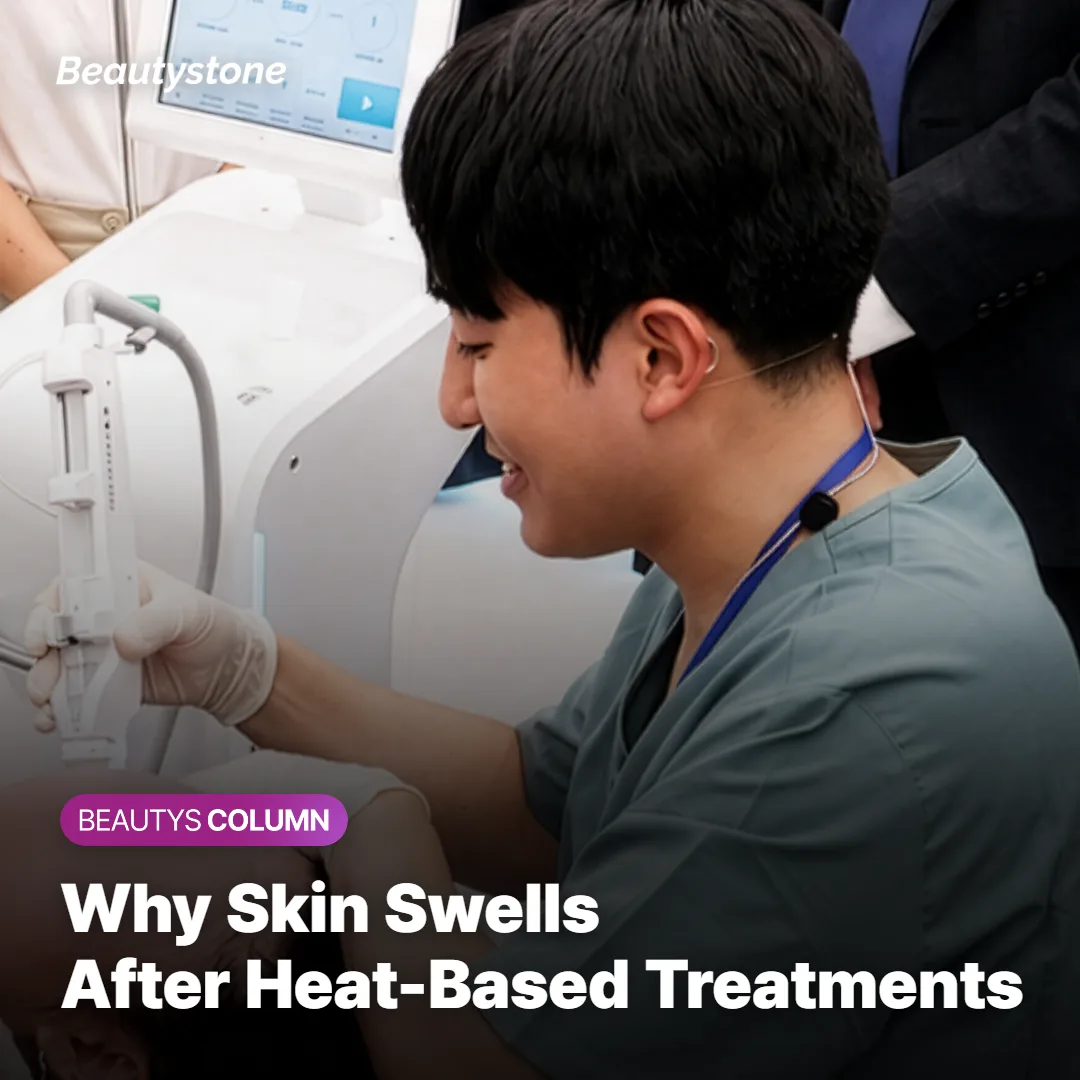 Illustration of skin layers reacting to heat energy from a lifting treatment