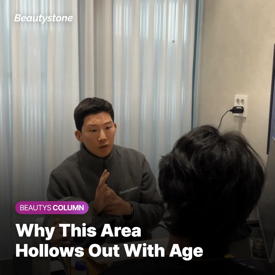 Diagram showing why temples and forehead hollow out with age