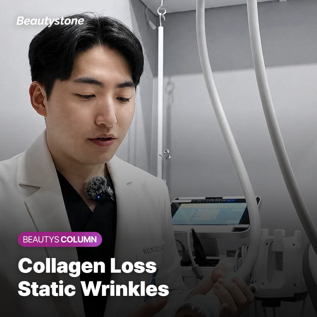 Illustration showing collagen and elastic fiber loss in skin structure causing static wrinkles