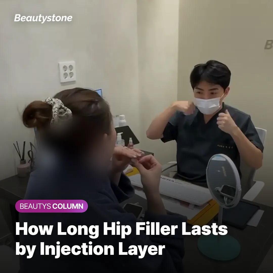 Comparison chart of how long hip filler results tend to last by injection layer