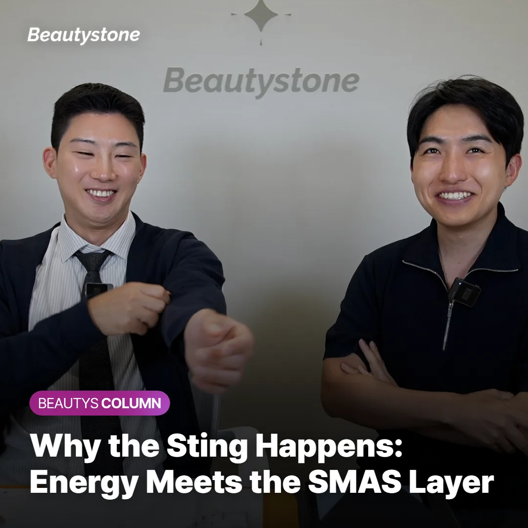 Diagram showing focused ultrasound energy converging at the SMAS layer beneath the skin