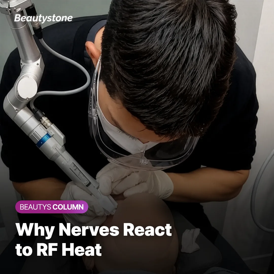 Diagram showing how RF energy warms nerves near the dermis during Thermage