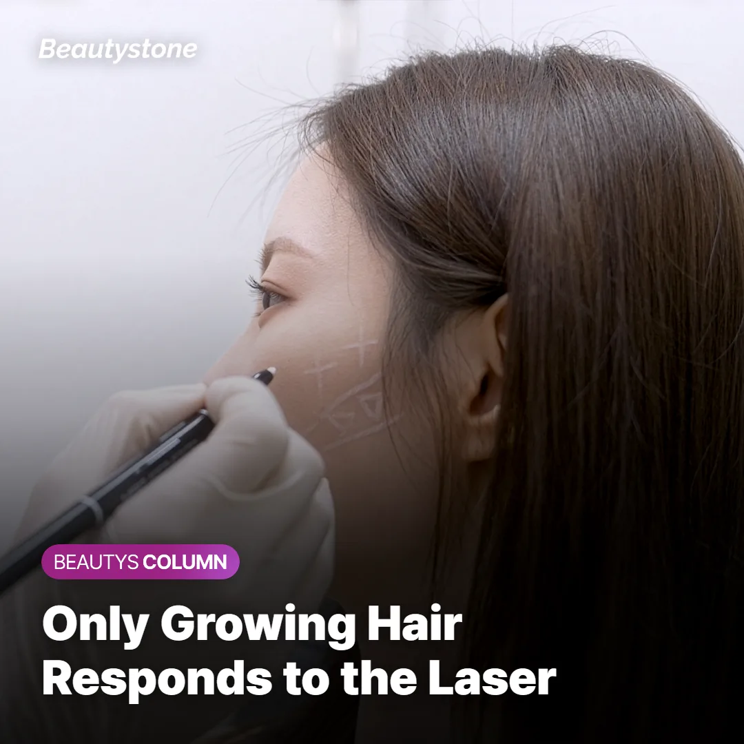 Diagram showing the hair growth cycle phases relevant to laser hair removal