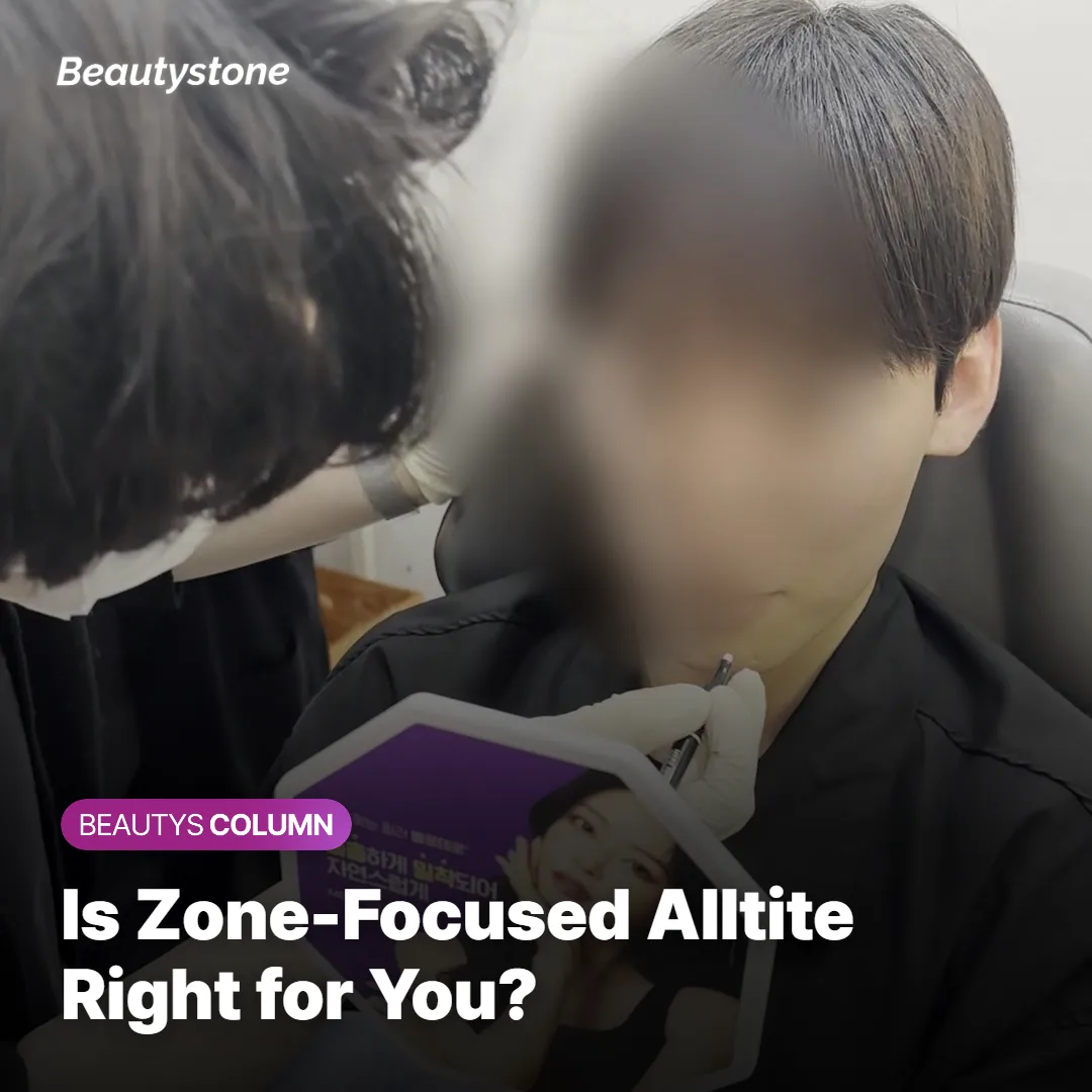 Illustration of a consultation discussing candidacy for zone-specific RF tightening