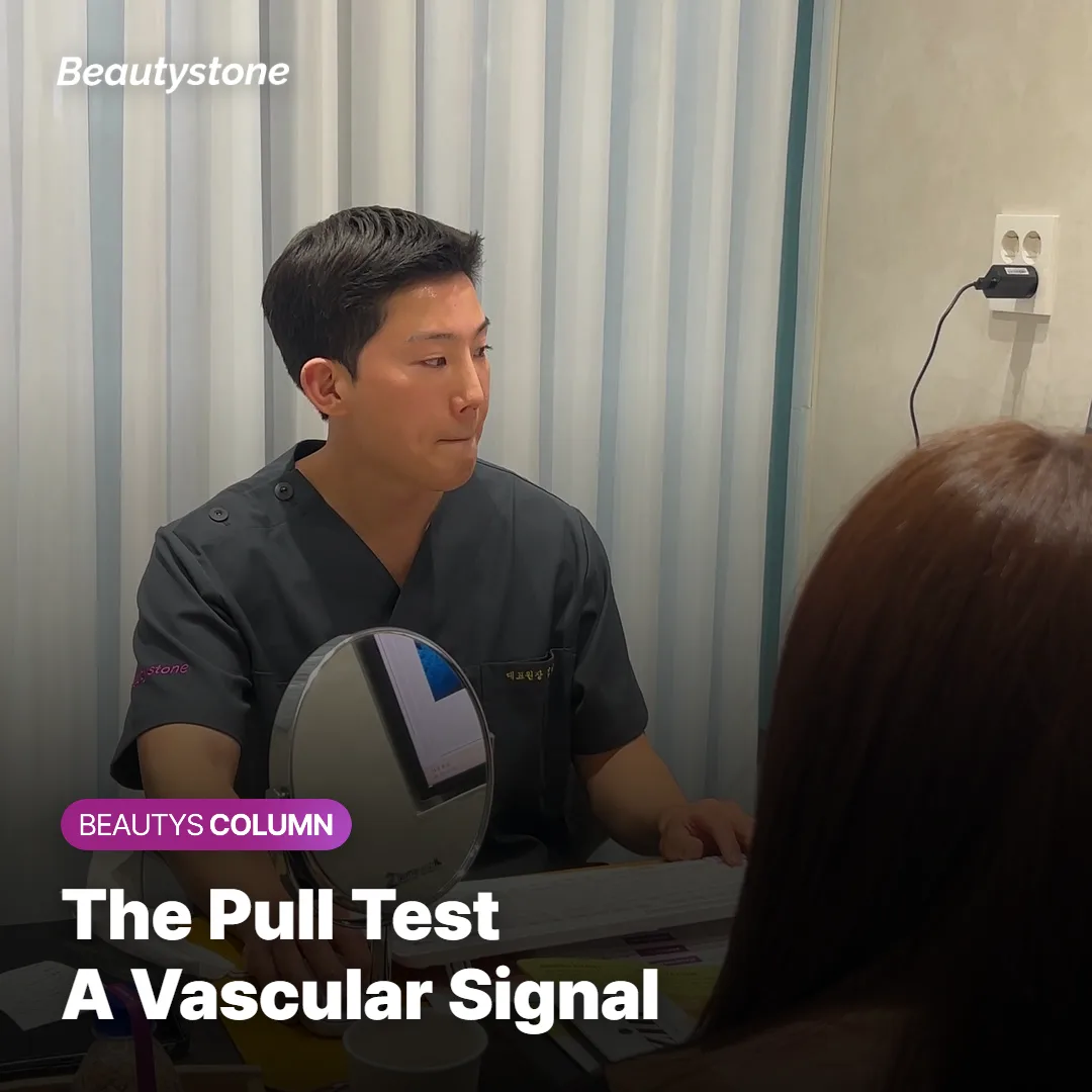 Diagram showing the pull test used to identify vascular dark circles at home