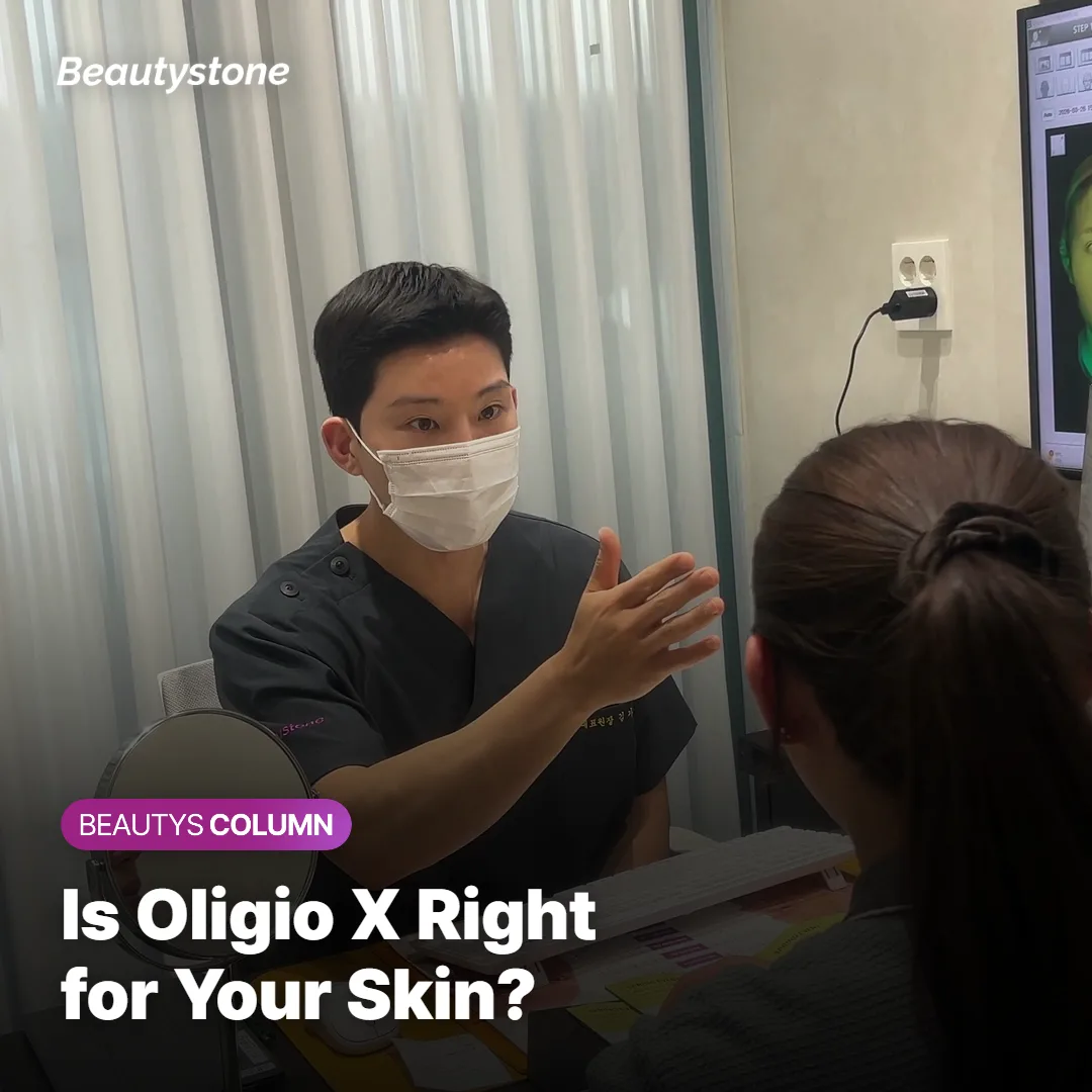 Illustration of a consultation discussing candidacy for Oligio X monopolar RF treatment