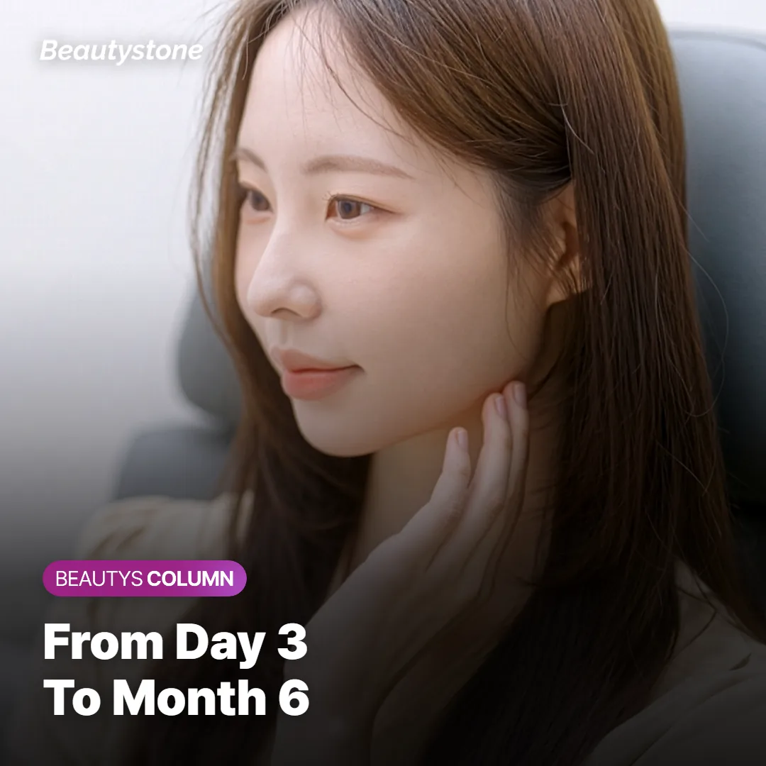 Calendar-style timeline showing Botox results appearing over days and lasting months