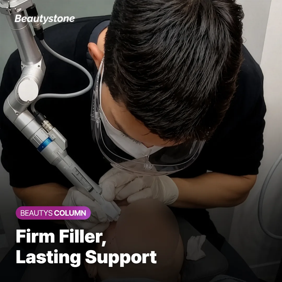 Illustration of firm filler supporting the nasolabial fold beside the nose