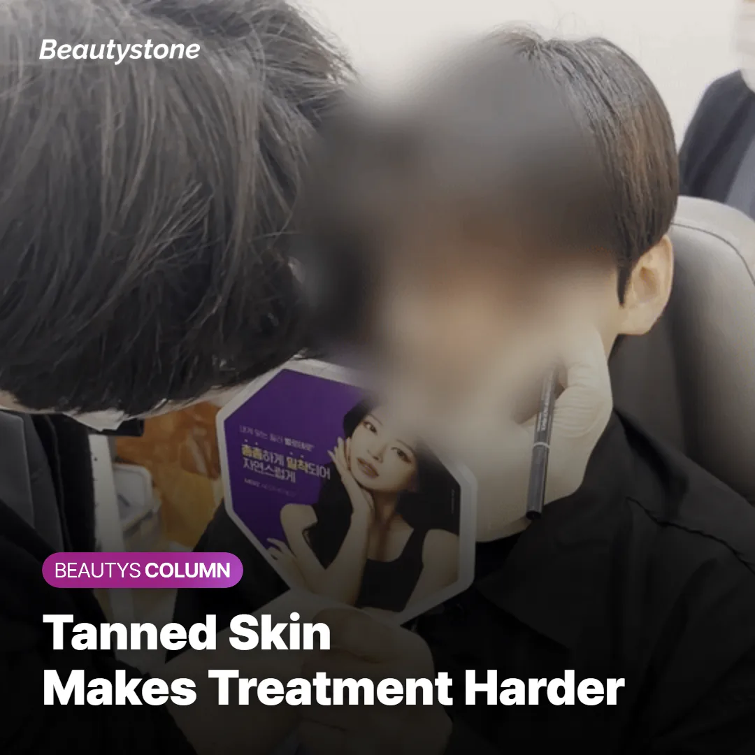 Illustration showing how tanned skin increases risk during laser hair removal