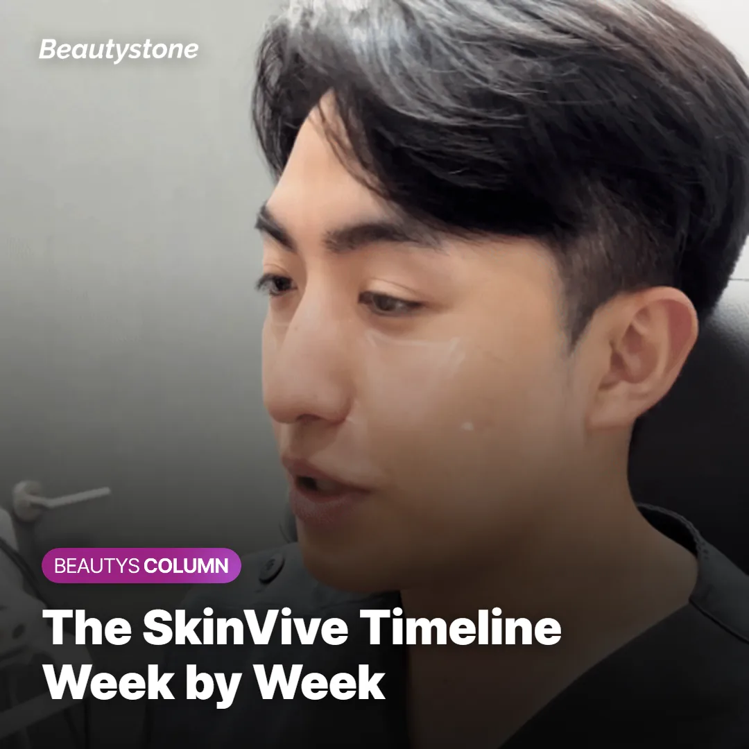 Graphic showing the SkinVive results timeline from injection to peak effect