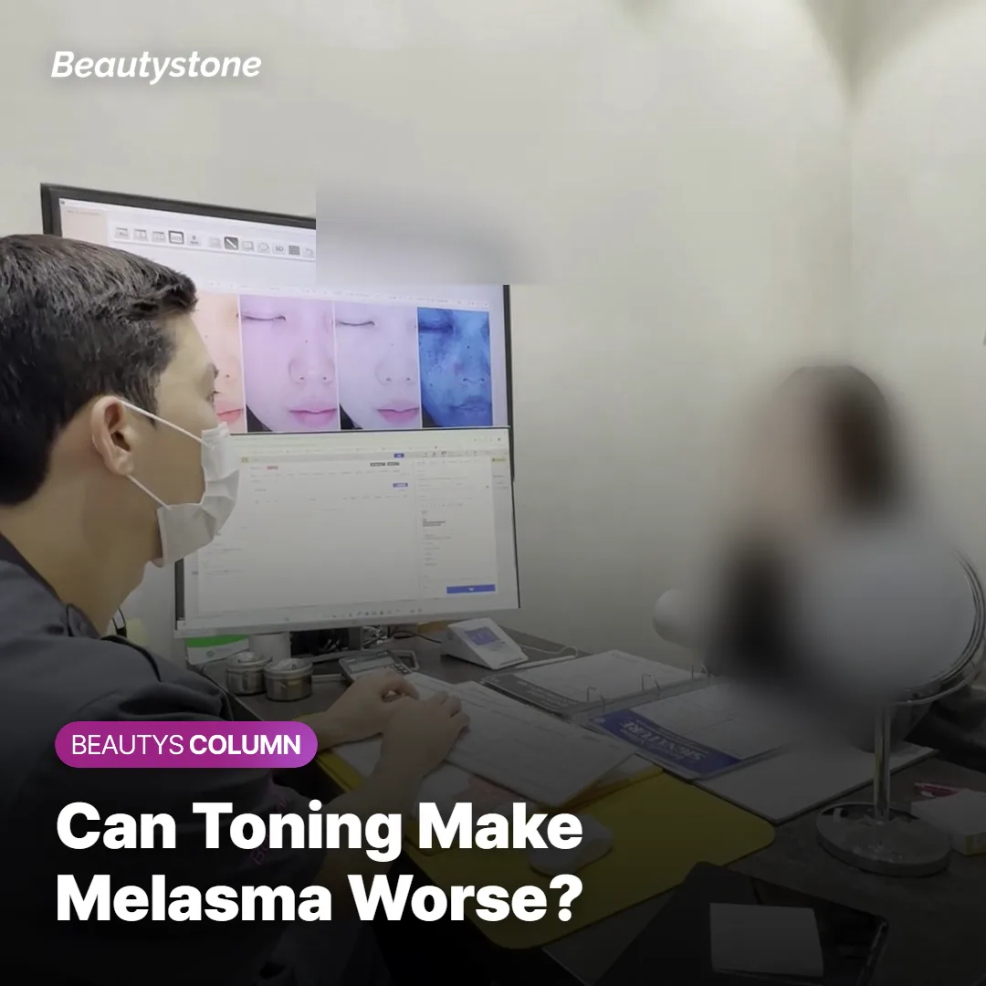 Photo of a consultation discussing melasma laser side effects